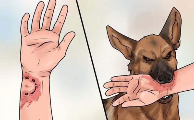 Tiêm vắc xin phòng dại? Khi nào thì cần thiết?