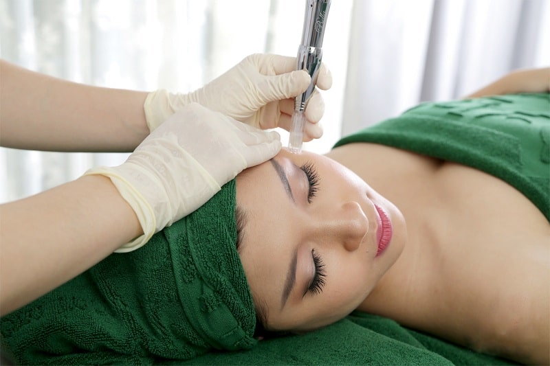 Quy trình thực hiện phi kim trị mụn như thế nào?