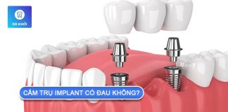 Quá trình cắm trụ implant có đau không? cắm trụ implant có đau không