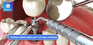 Thực hiện quy trình trồng răng implant có đau không? trồng răng implant có đau không