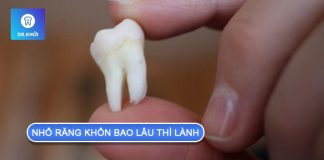 Nhổ răng khôn bao lâu thì lành? Lưu ý sau khi nhổ răng nhổ răng khôn bao lâu thì lành