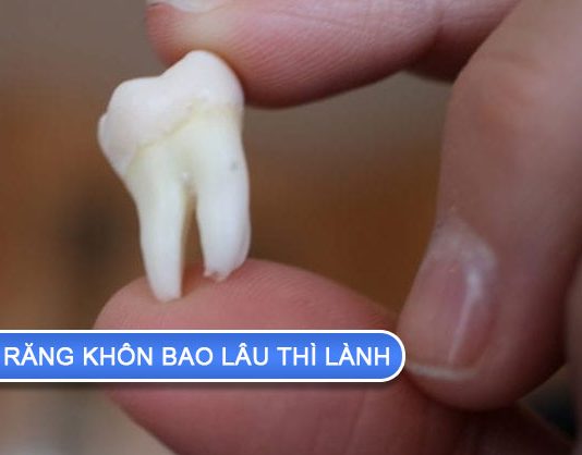 Nhổ răng khôn bao lâu thì lành? Lưu ý sau khi nhổ răng nhổ răng khôn bao lâu thì lành