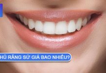 Phủ răng sứ giá bao nhiêu? Phủ răng sứ có an toàn không? phủ răng sứ giá bao nhiêu