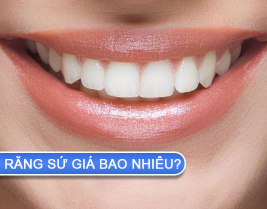 Phủ răng sứ giá bao nhiêu? Phủ răng sứ có an toàn không? phủ răng sứ giá bao nhiêu