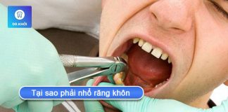 Tại sao phải nhổ răng khôn và khi nào không nên nhổ? tại sao phải nhổ răng khôn